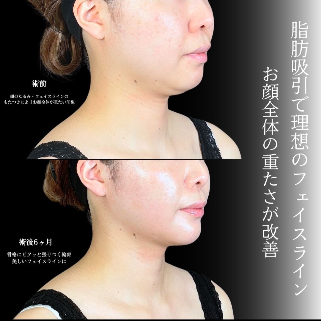 No.19147の症例写真1