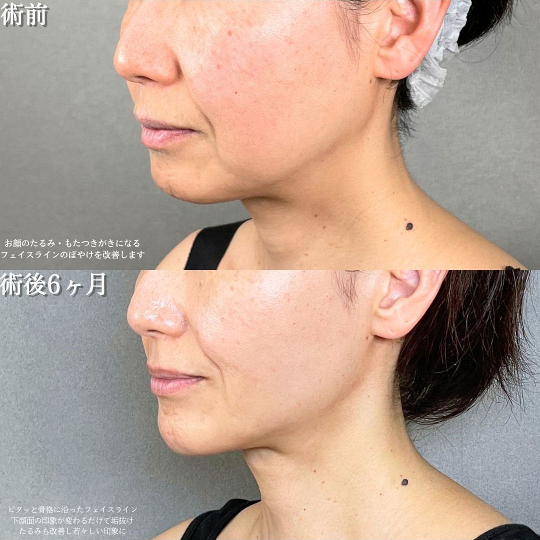 No.19252の症例写真1