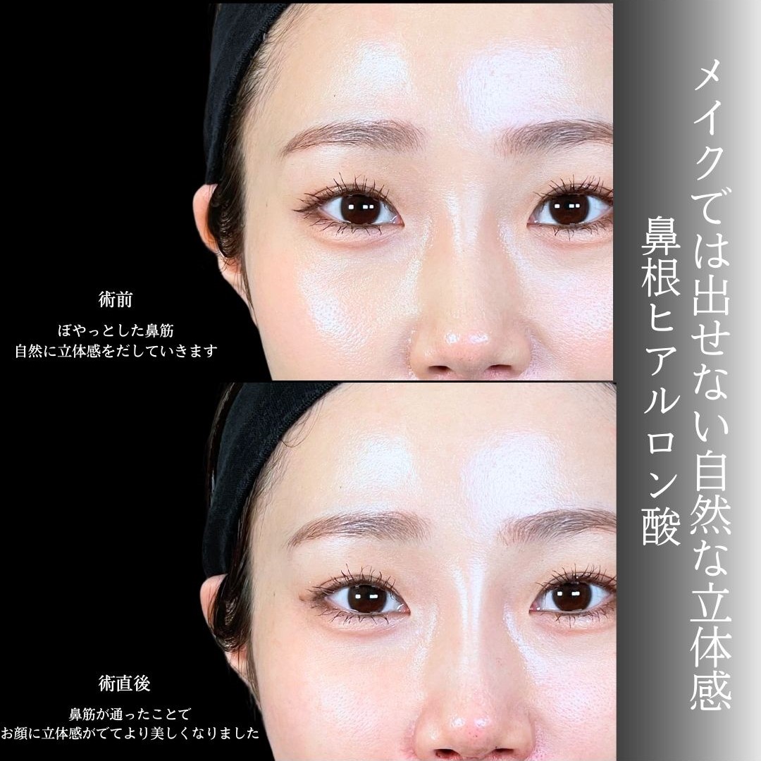 No.19273の症例写真1