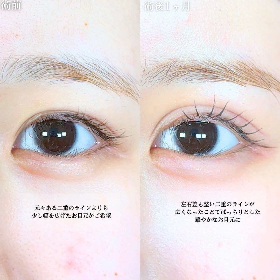 No.19281の症例写真1