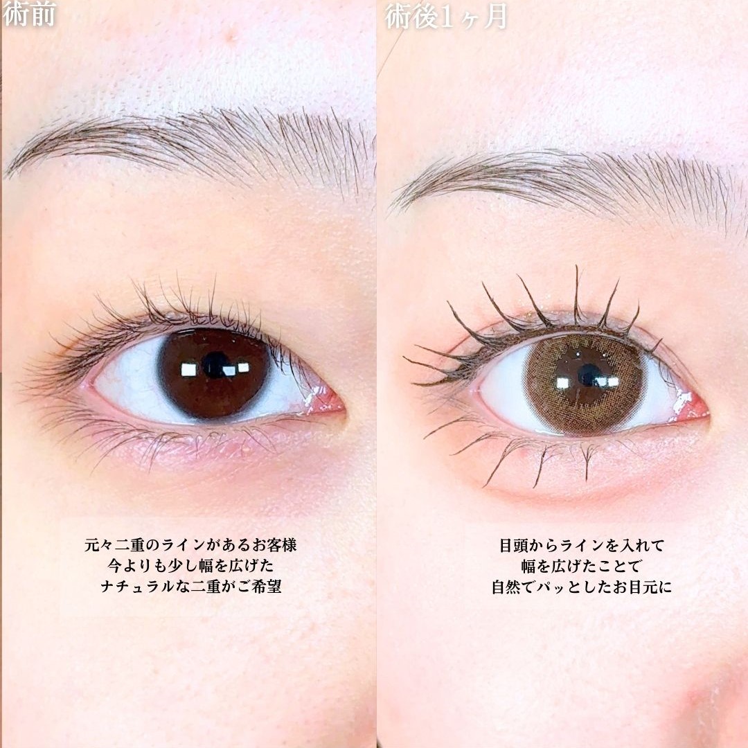 No.18990の症例写真1