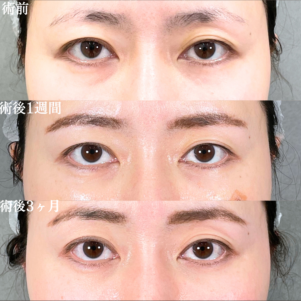 No.19065の症例写真1