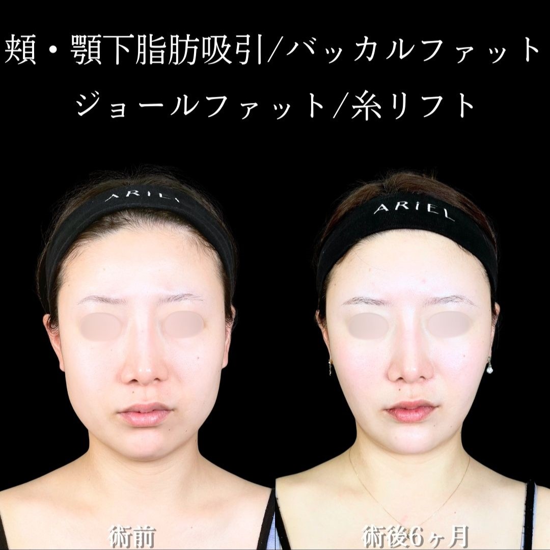 No.19058の症例写真2