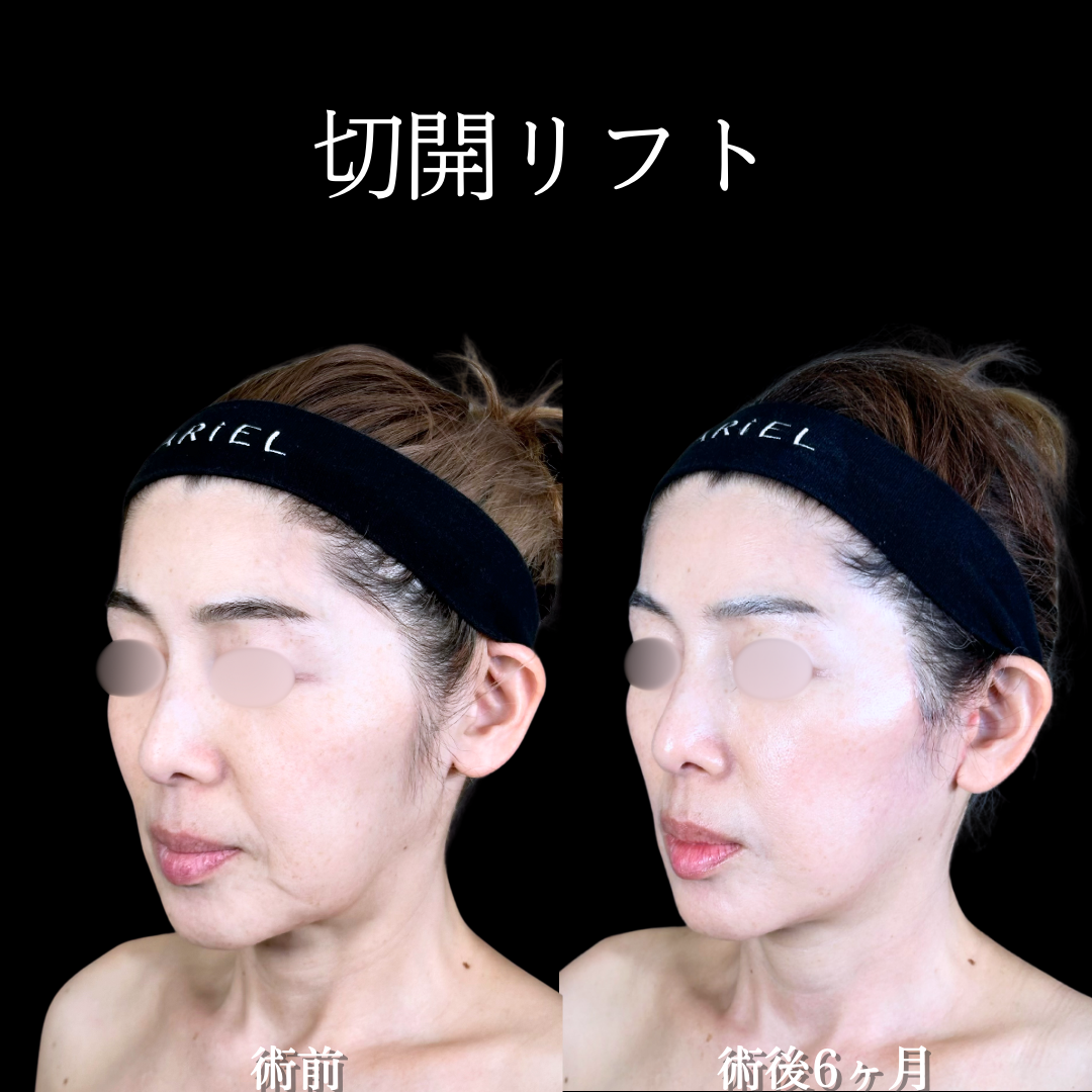 No.19076の症例写真1