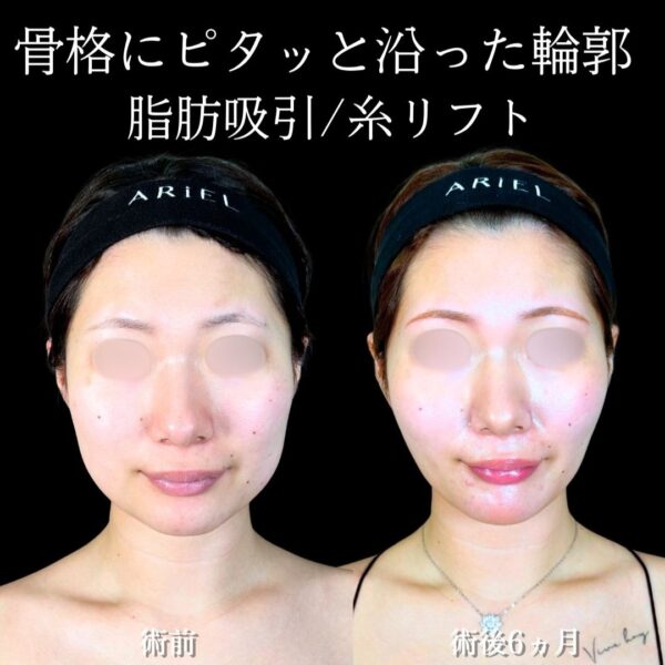 No.19295の症例写真 No.19295の症例写真