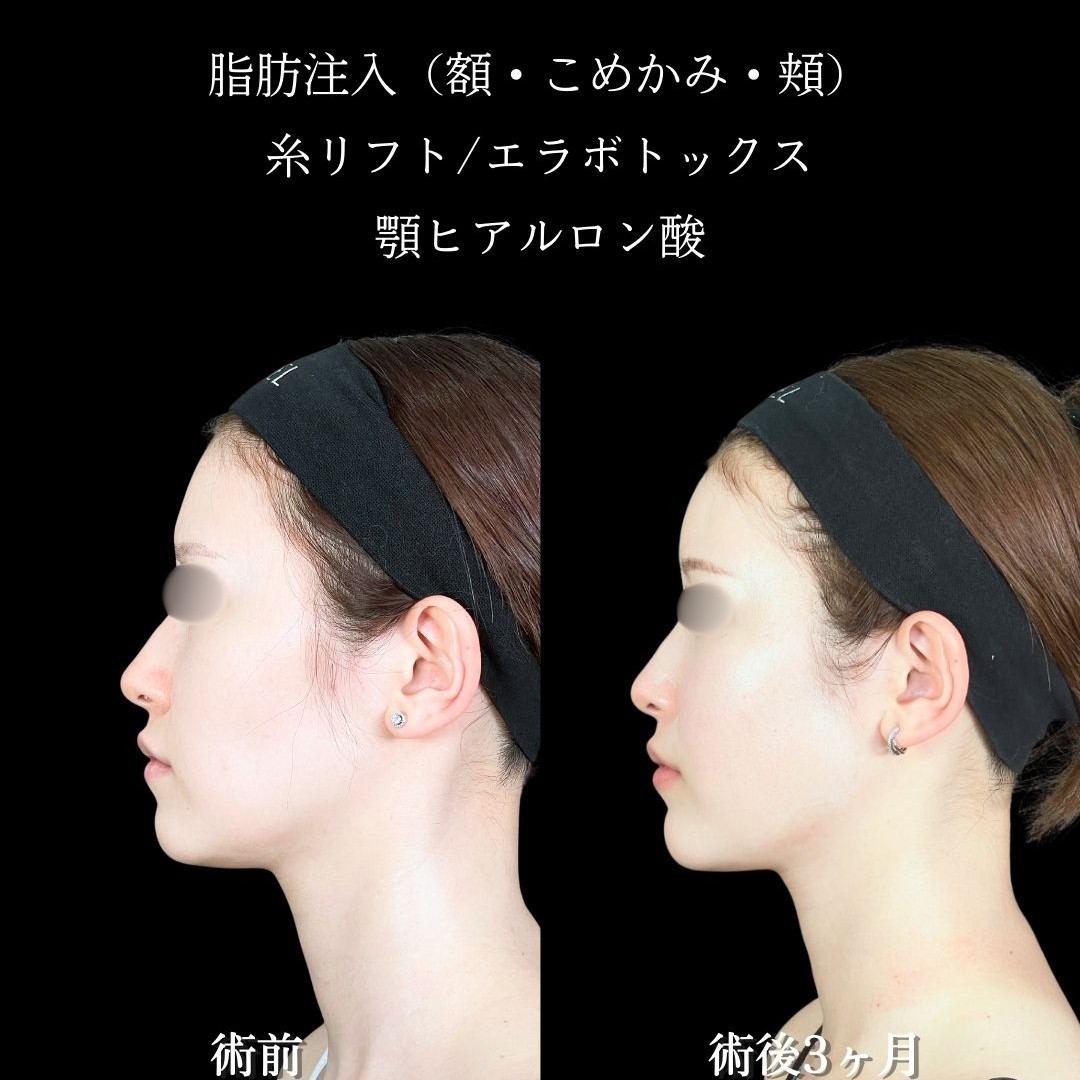 No.19316の症例写真2