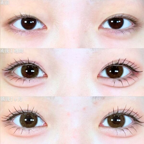 No.19084の症例写真