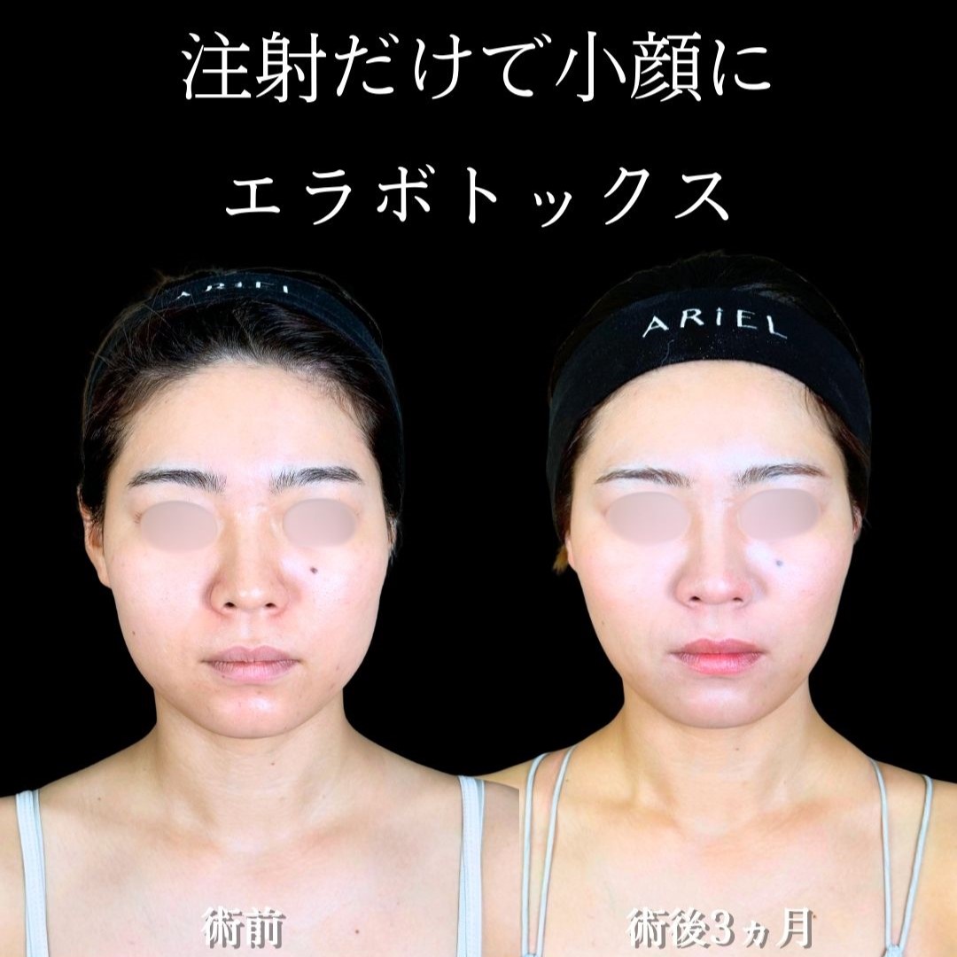 No.19098の症例写真