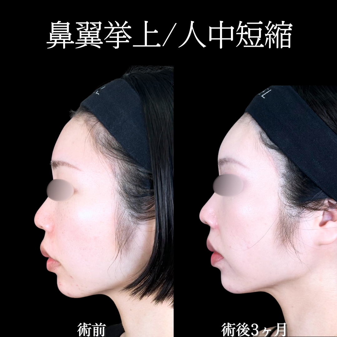 No.19331の症例写真1