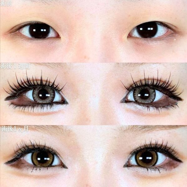 No.19121の症例写真