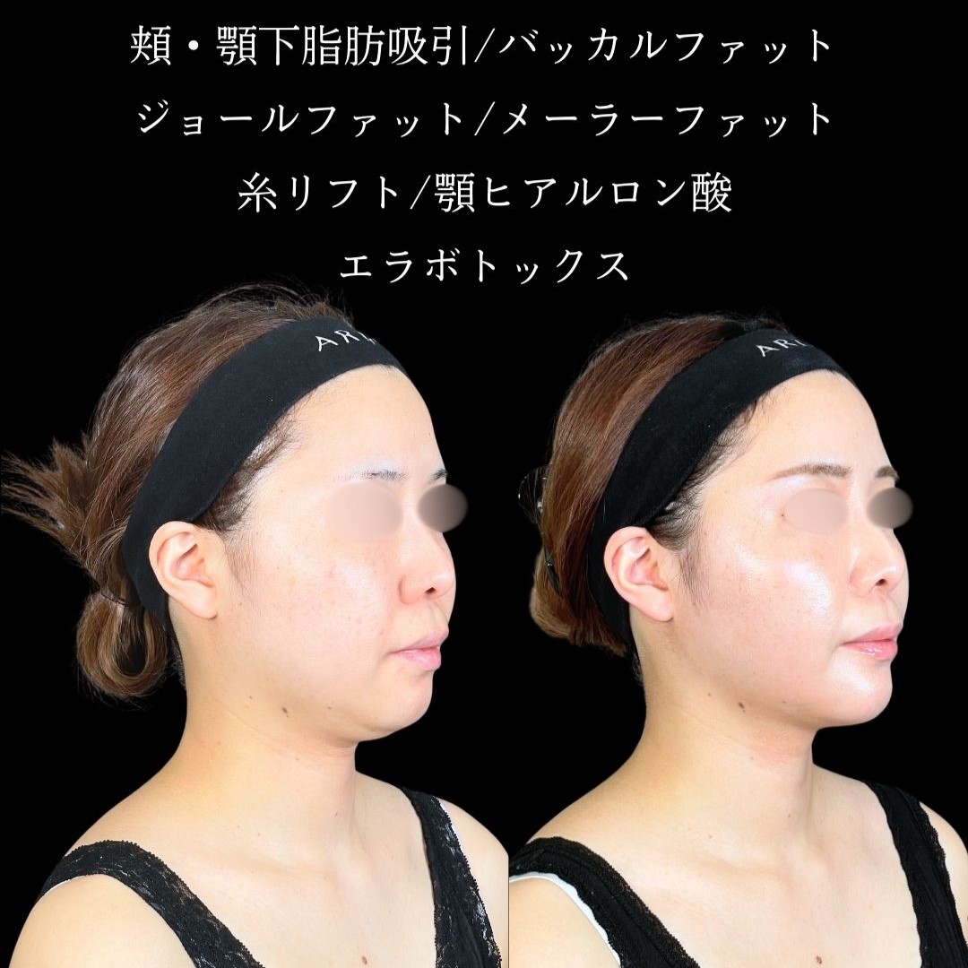 No.19147の症例写真2