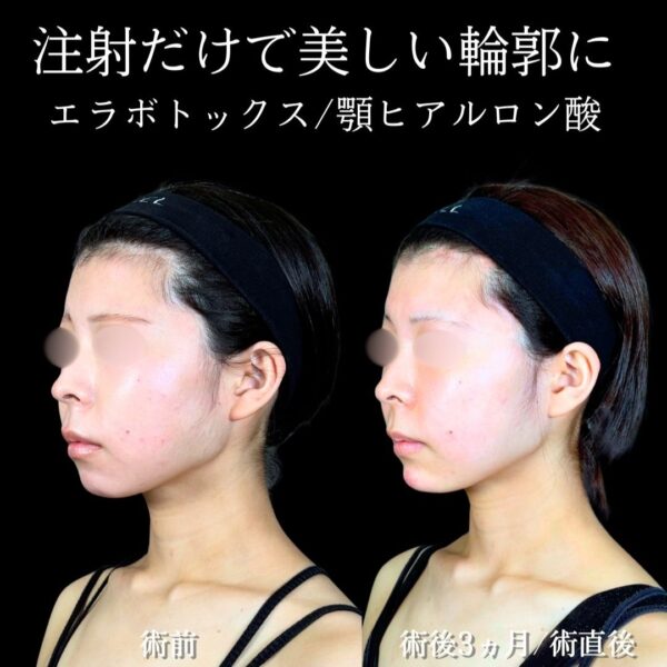 No.19237の症例写真 No.19237の症例写真