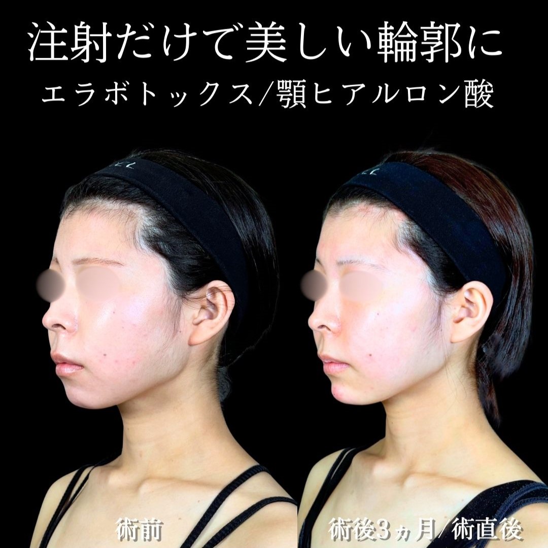 No.19237の症例写真