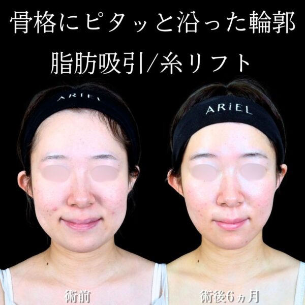 No.19042の症例写真