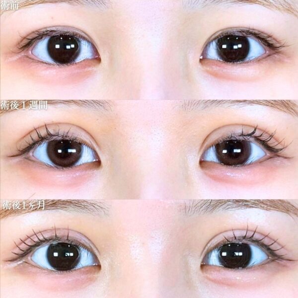 No.19251の症例写真 No.19251の症例写真