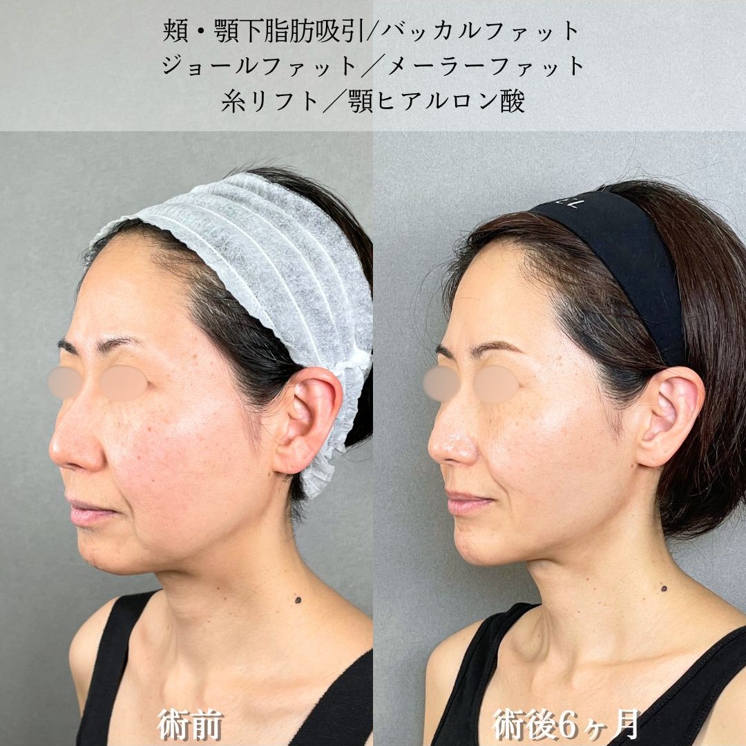 No.19252の症例写真2