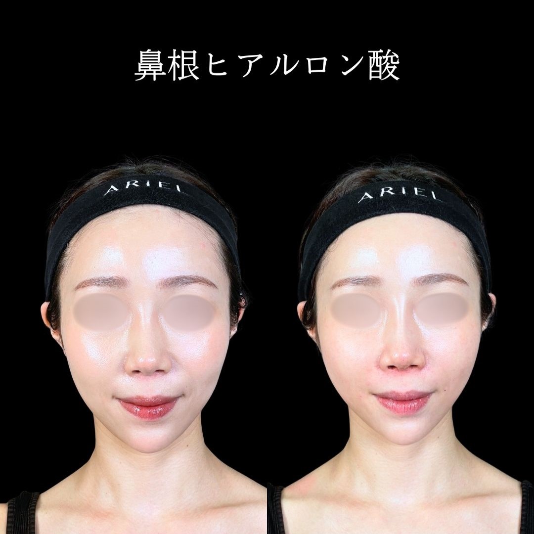 No.19273の症例写真2