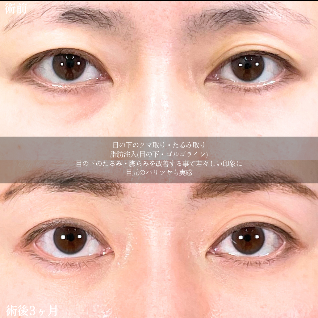 No.19065の症例写真2