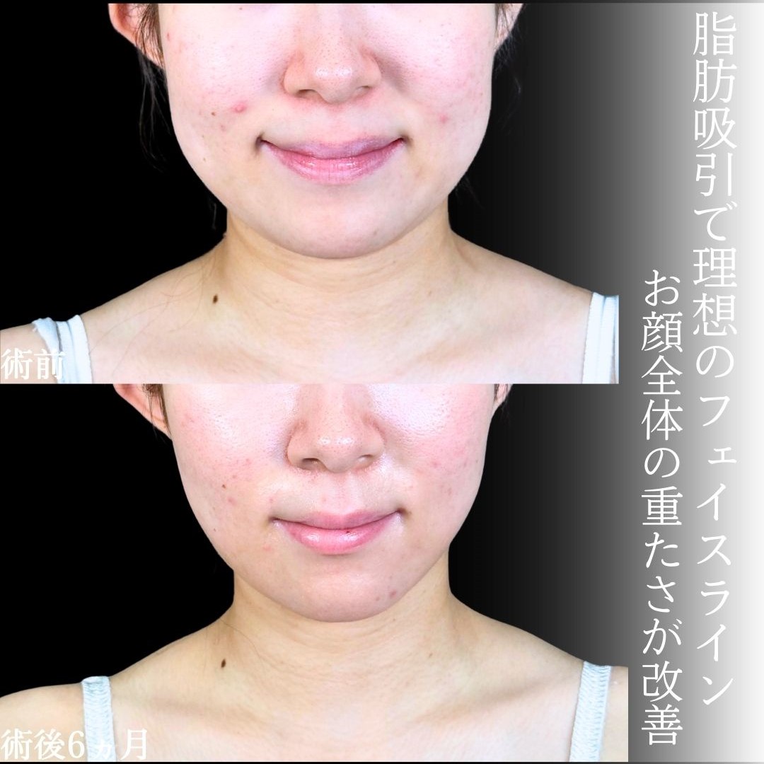 No.19042の症例写真1