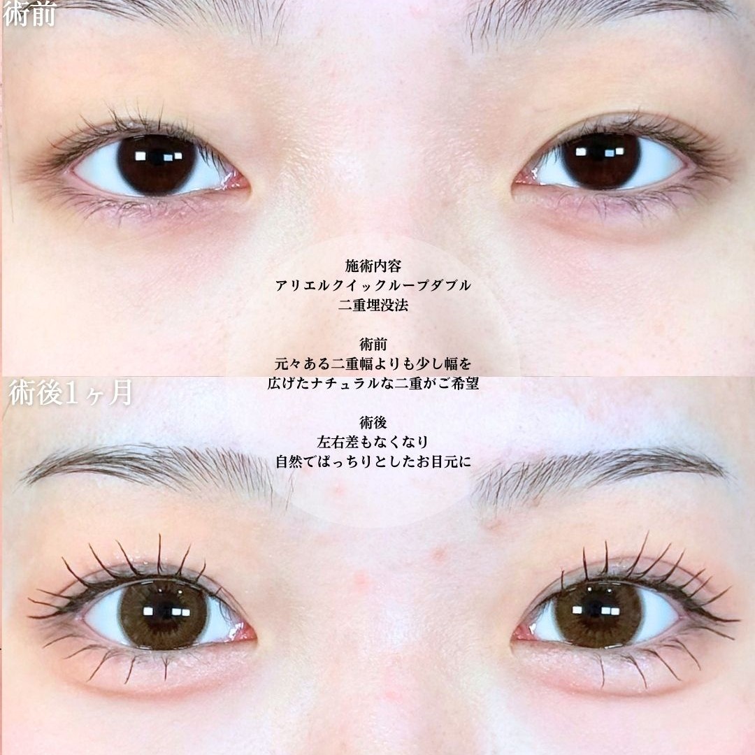 No.19084の症例写真1