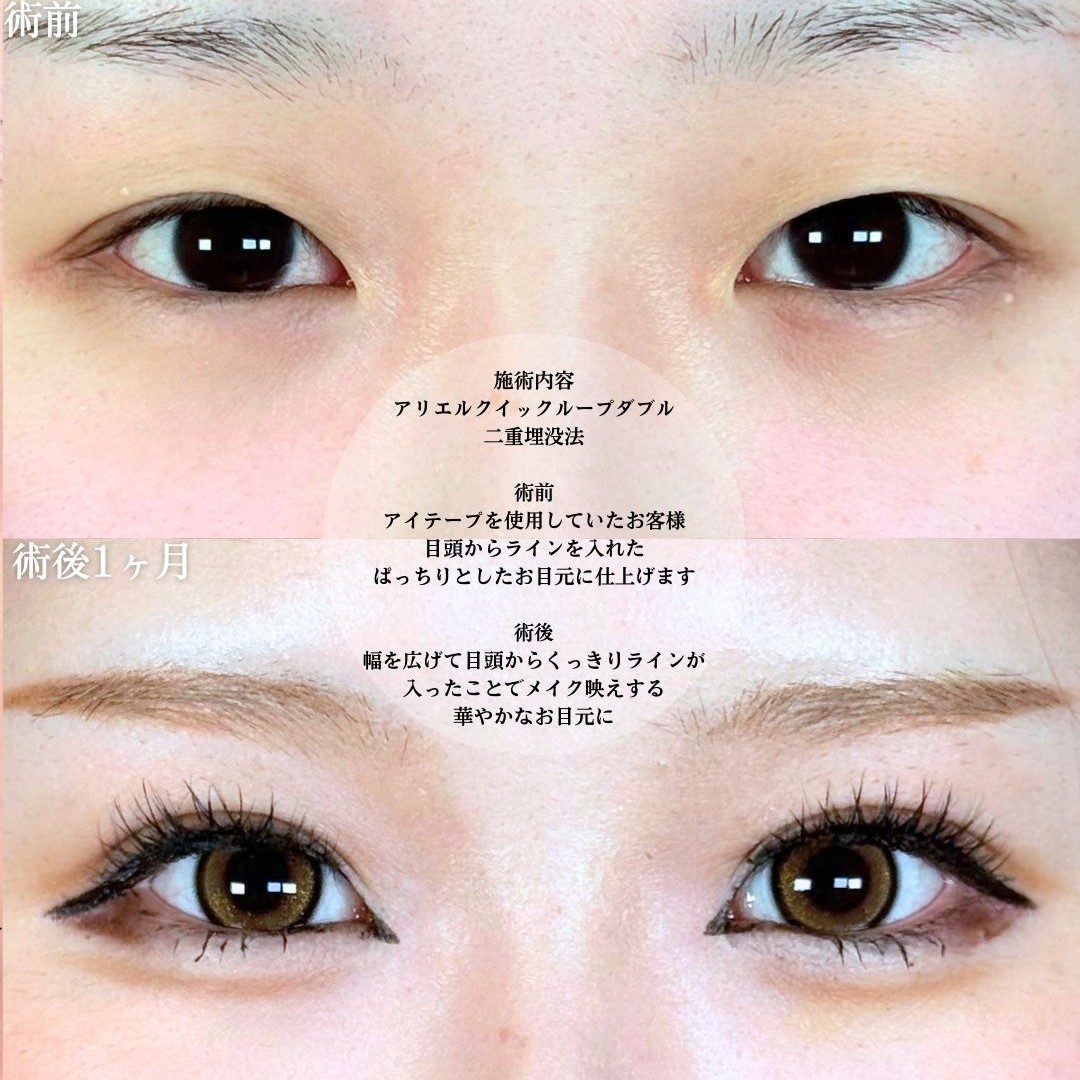 No.19121の症例写真1