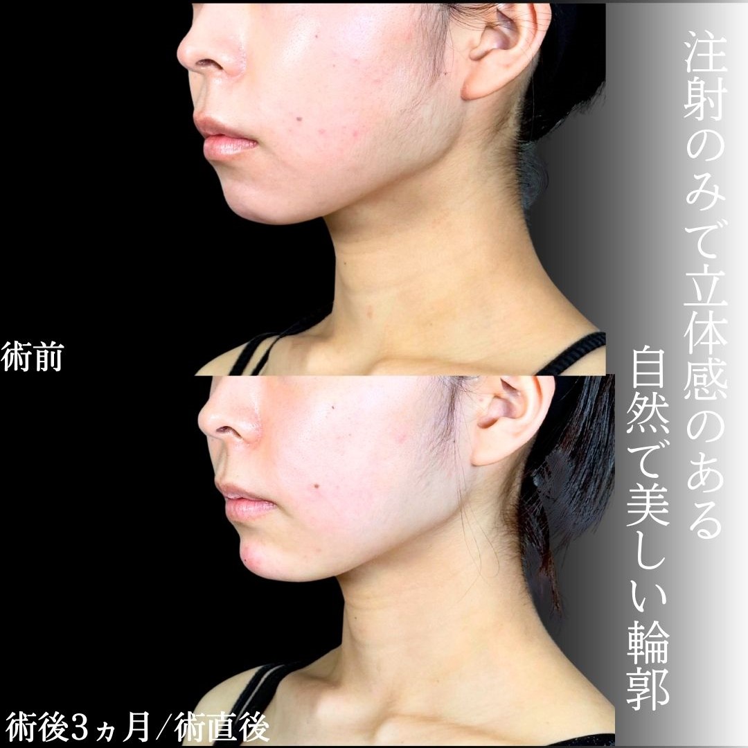 No.19237の症例写真1