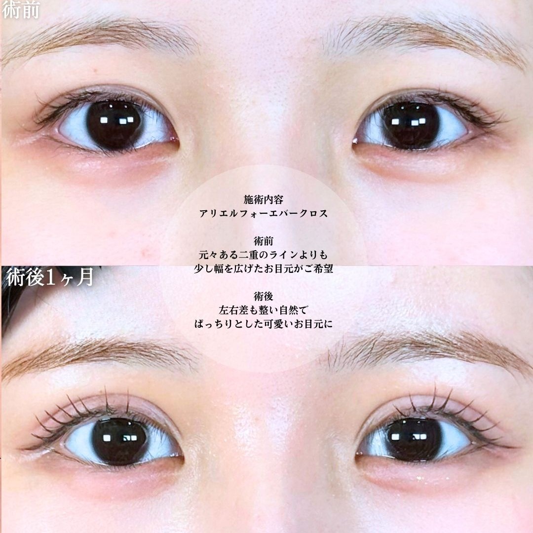 No.19251の症例写真1