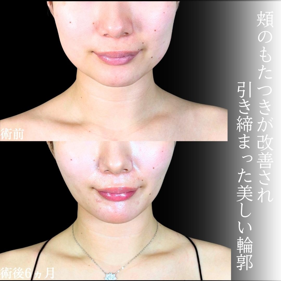 No.19295の症例写真1