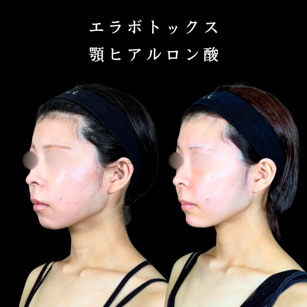 No.19237の症例写真2