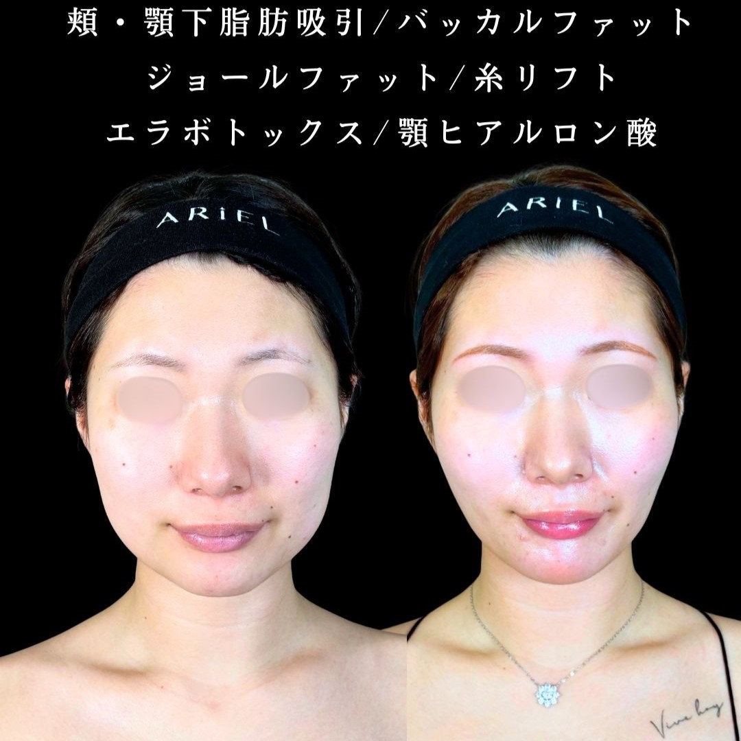 No.19295の症例写真2