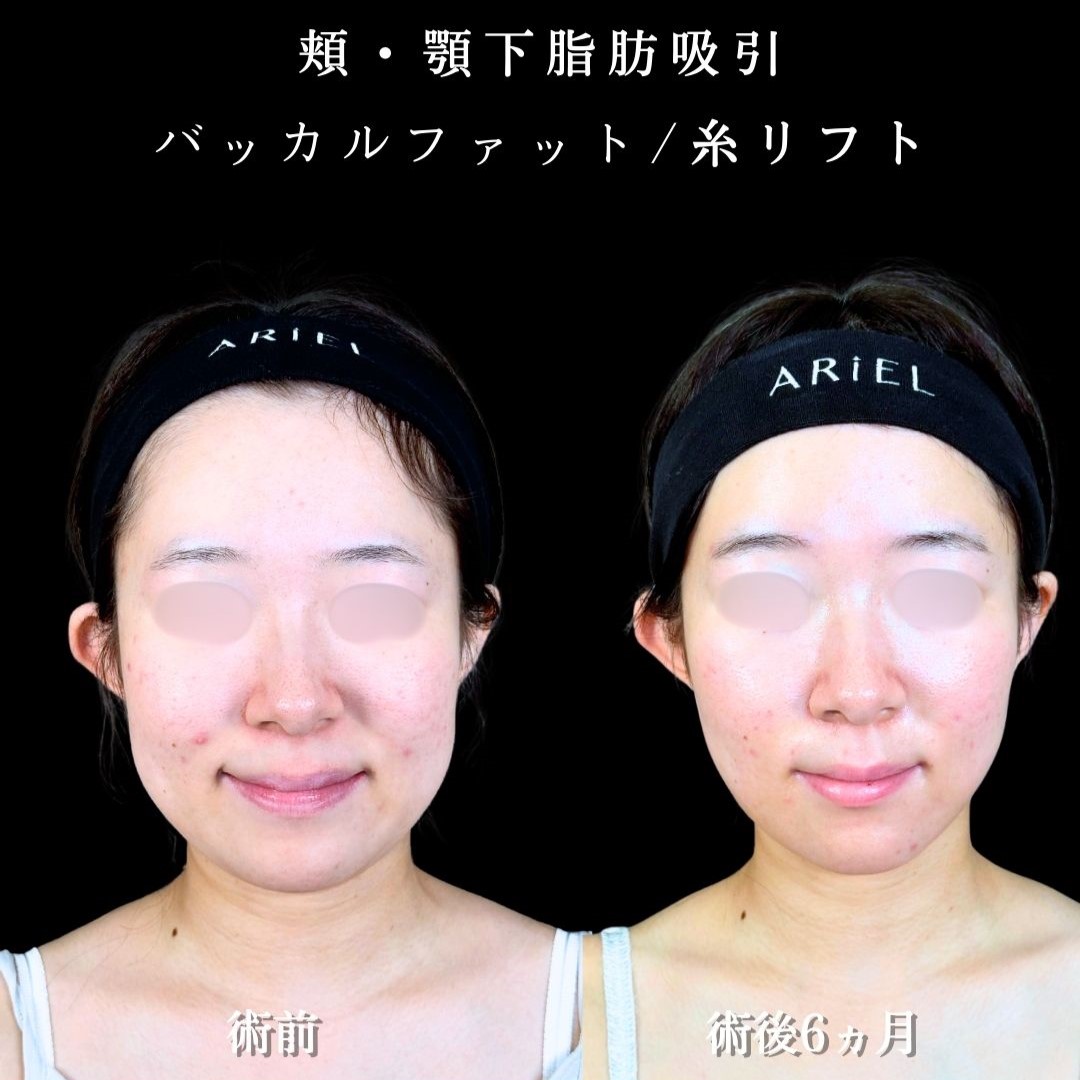 No.19042の症例写真2