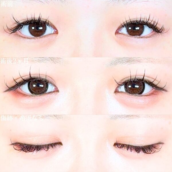 No.19013の症例写真