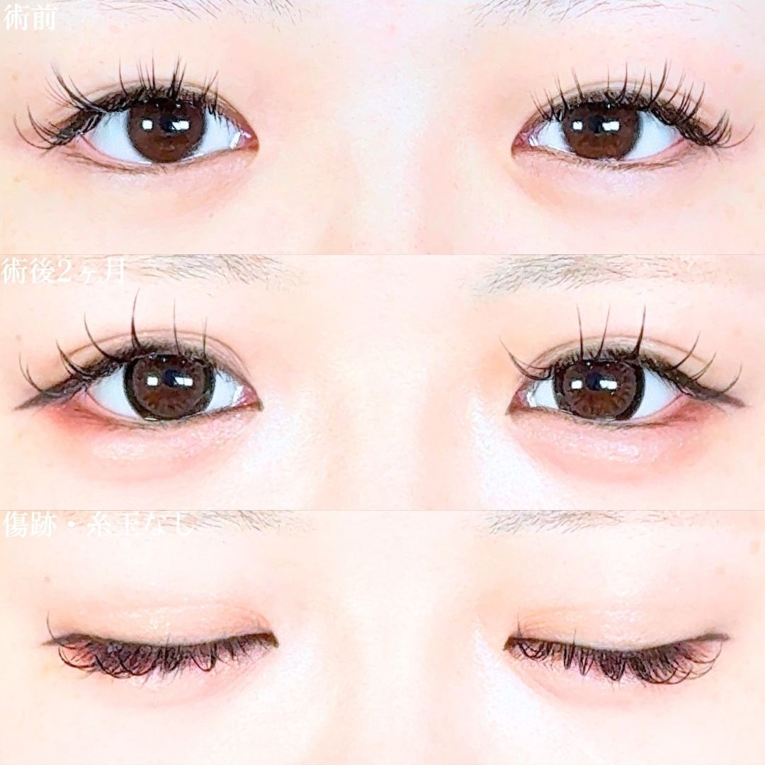 No.19013の症例写真