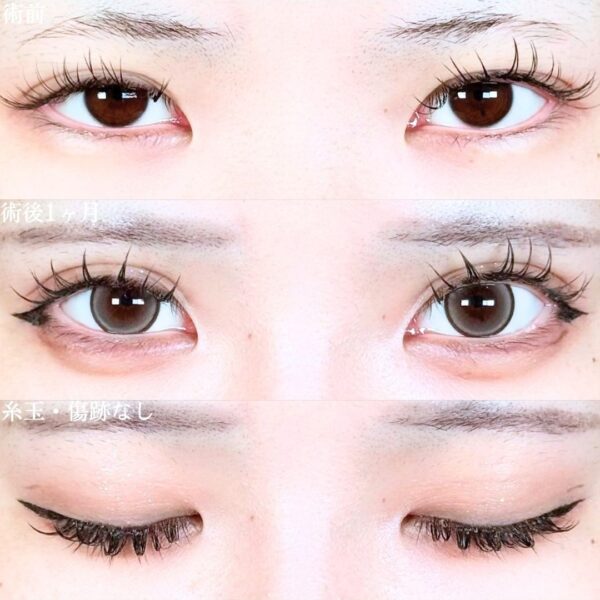 No.19288の症例写真 No.19288の症例写真