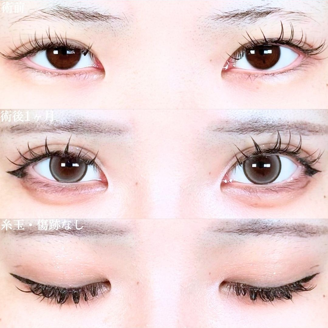 No.19288の症例写真