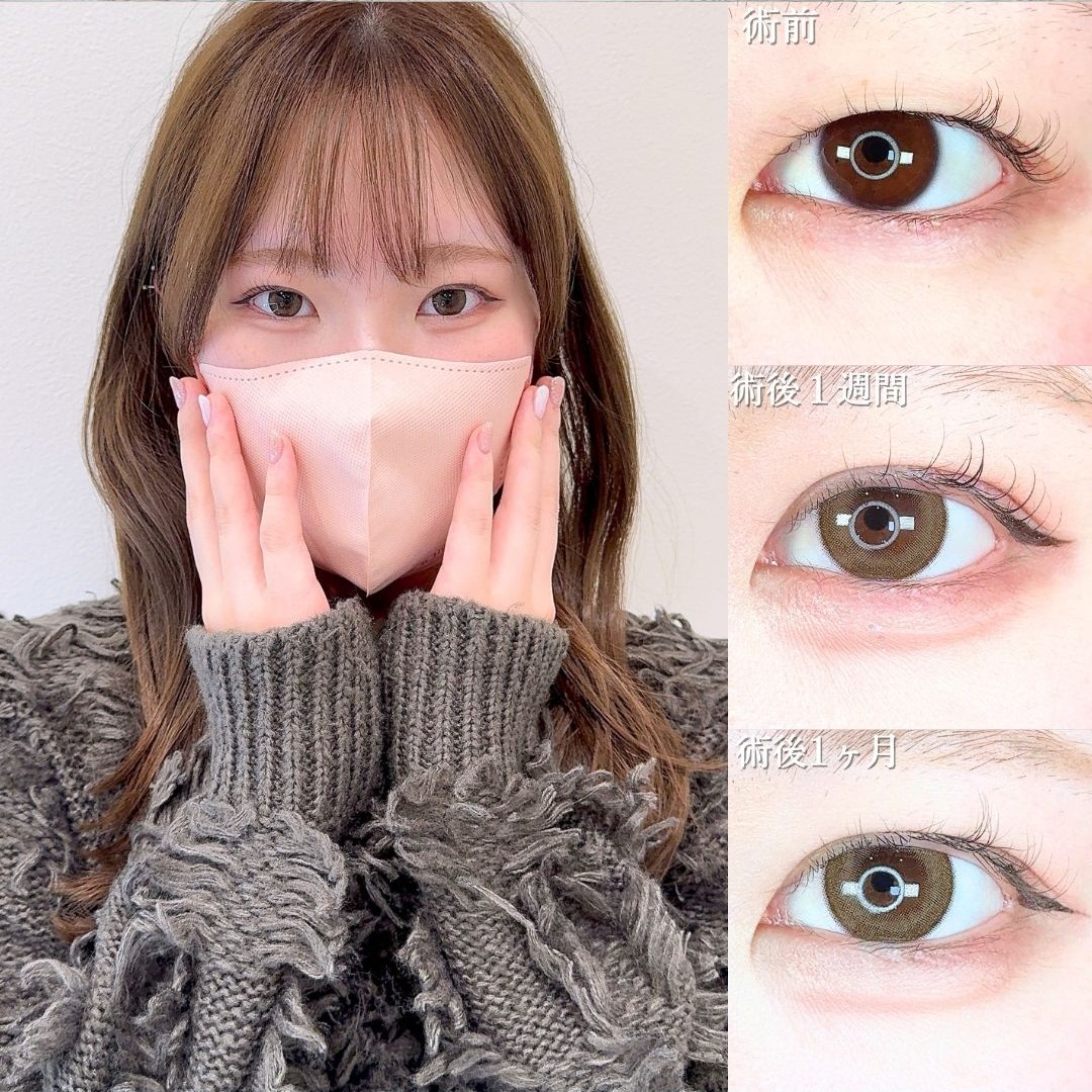 No.19323の症例写真