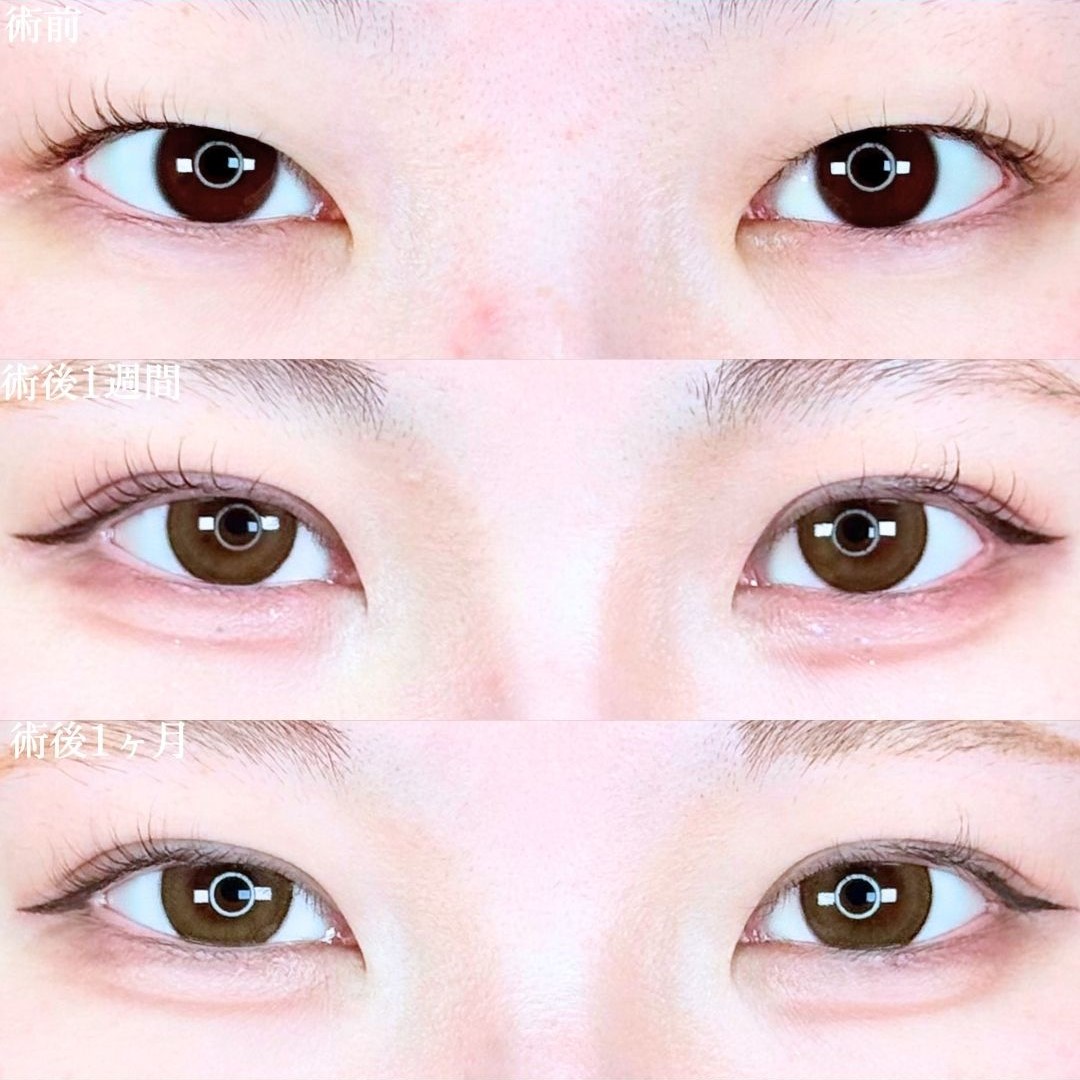 No.19369の症例写真