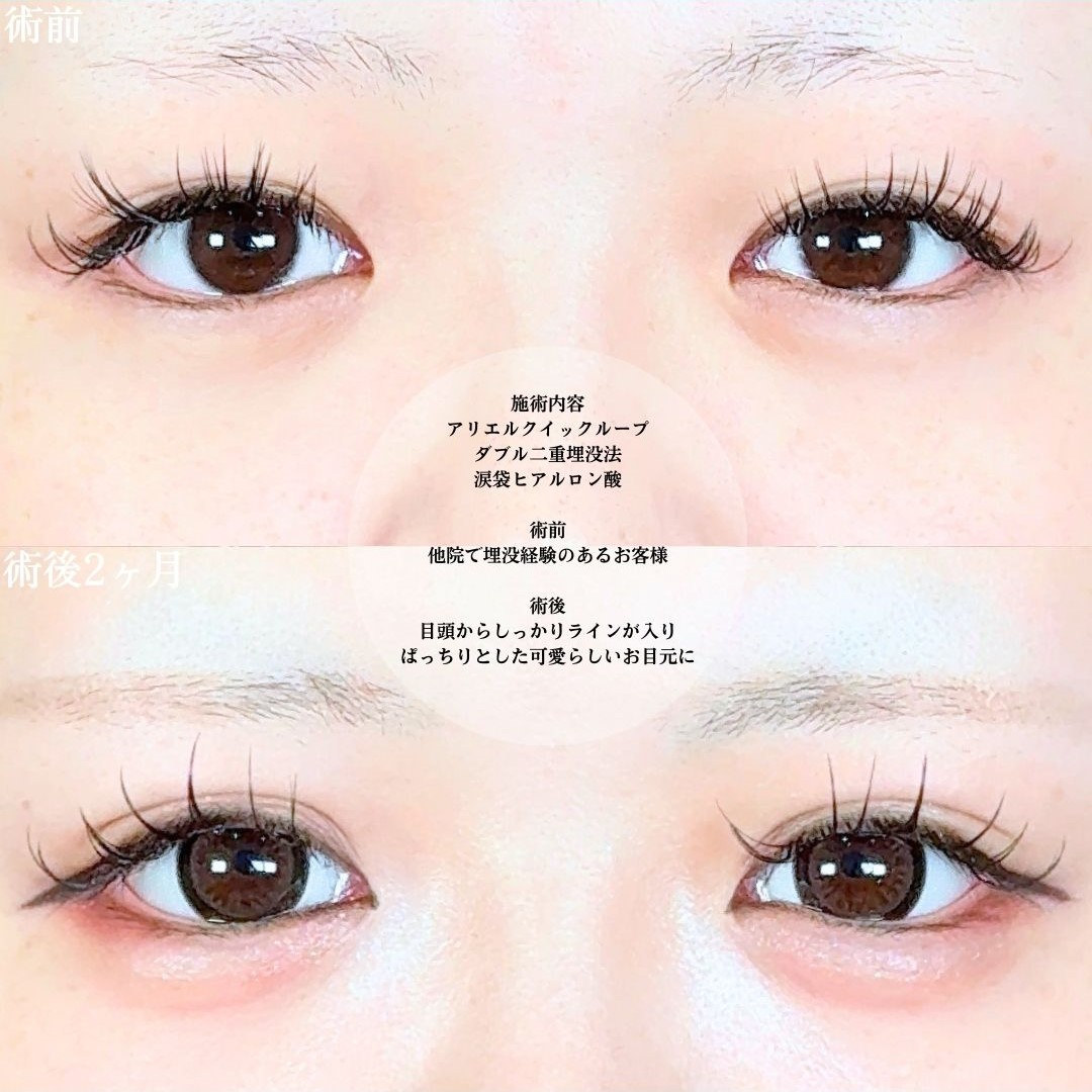 No.19013の症例写真1