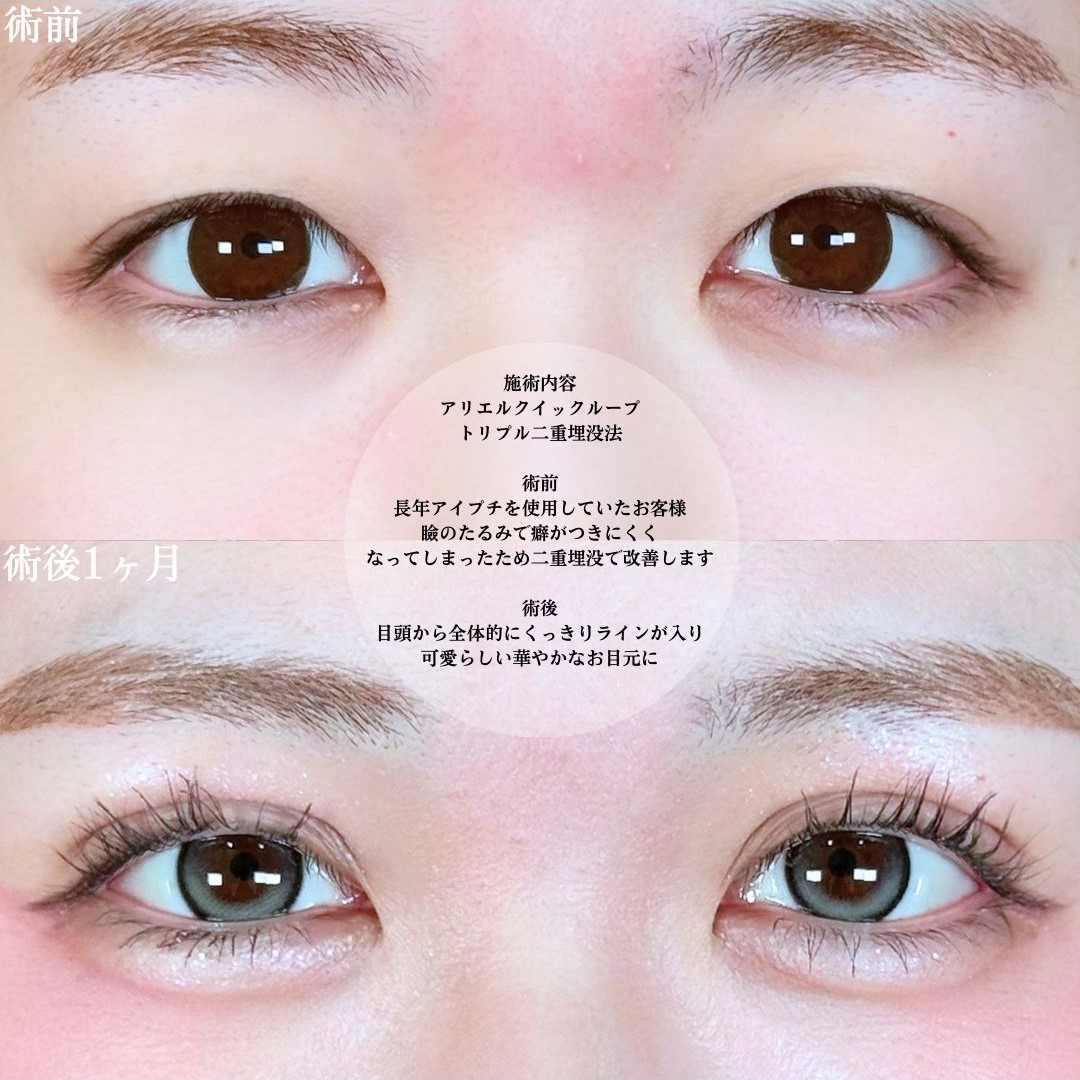 No.19051の症例写真1