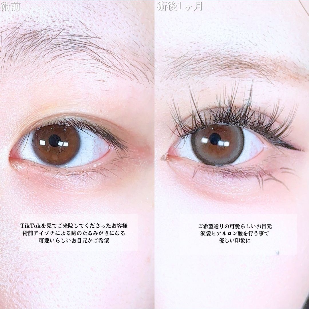 No.19117の症例写真1