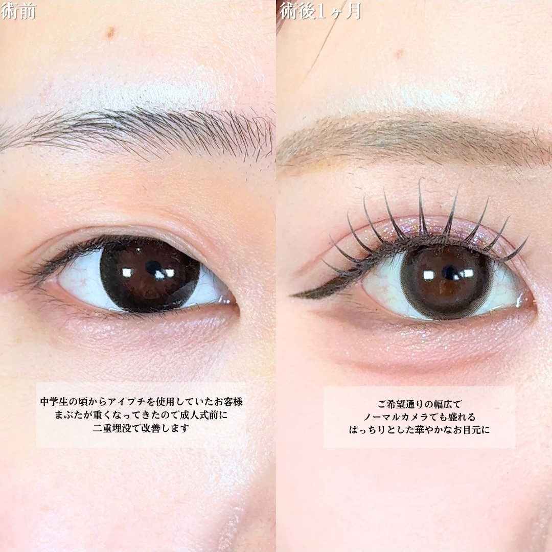 No.19156の症例写真1