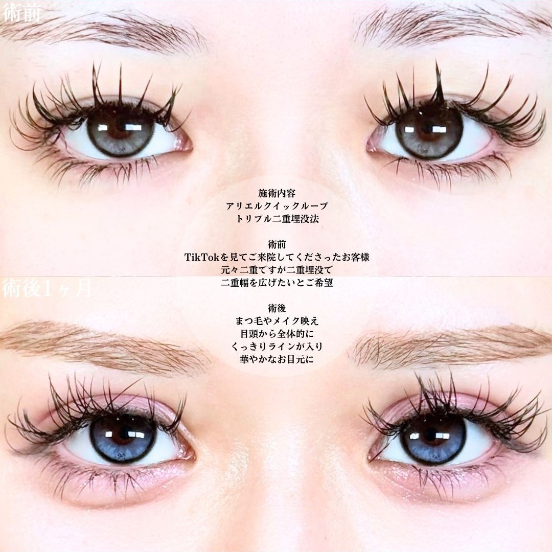 No.19222の症例写真1