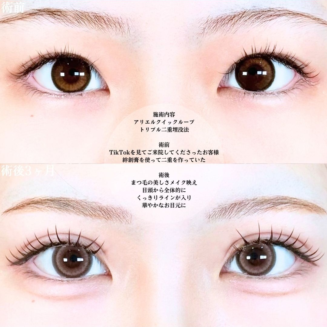 No.19245の症例写真1