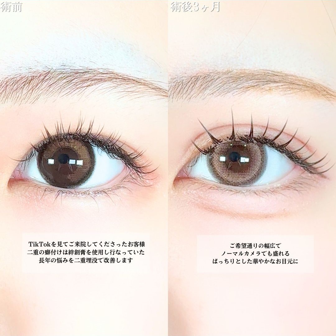 No.19265の症例写真1