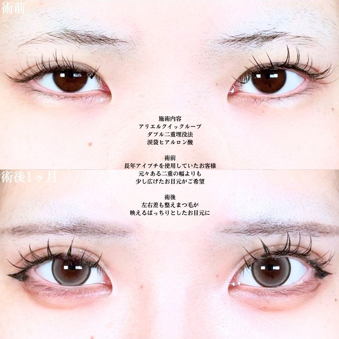 No.19288の症例写真1