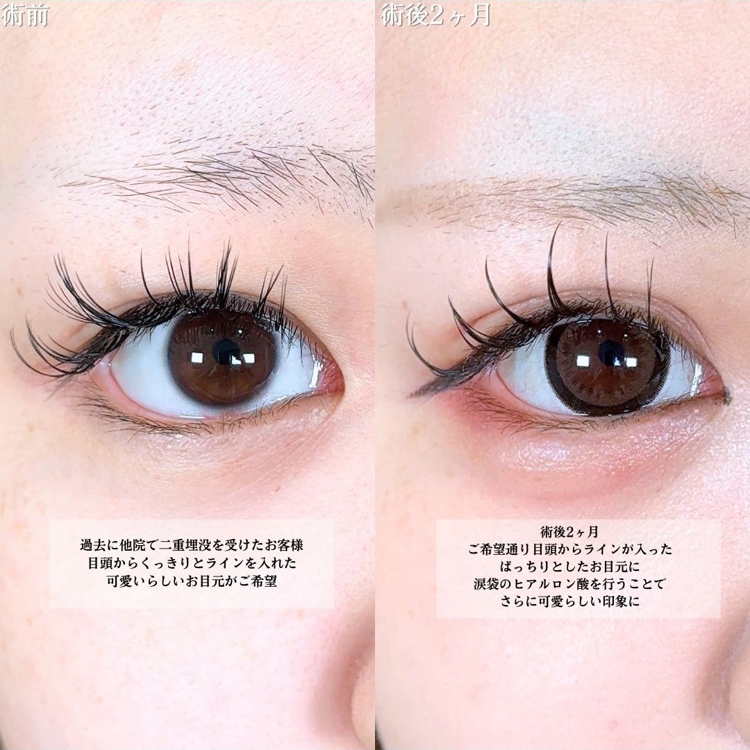 No.18997の症例写真1