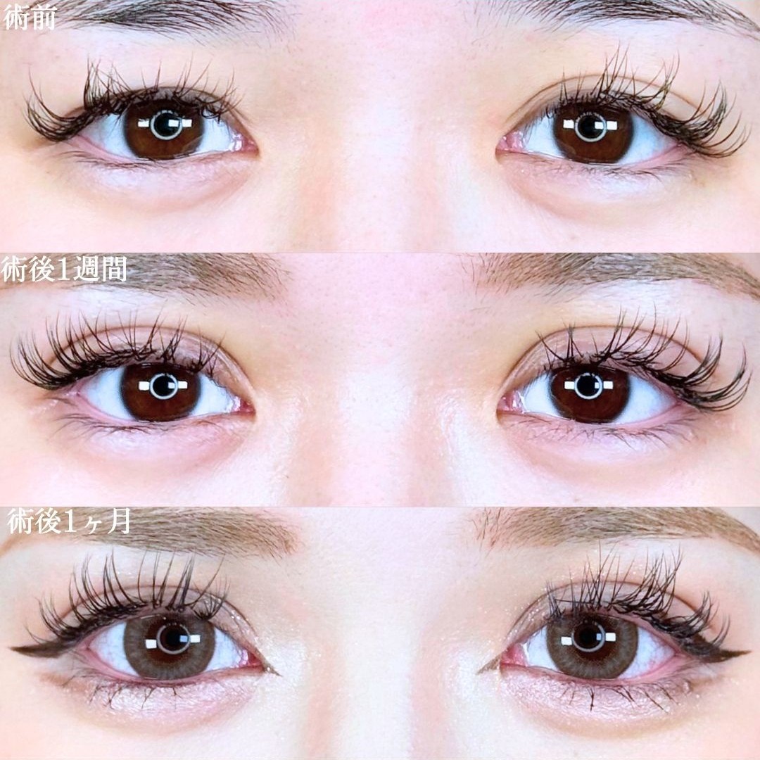 No.19107の症例写真