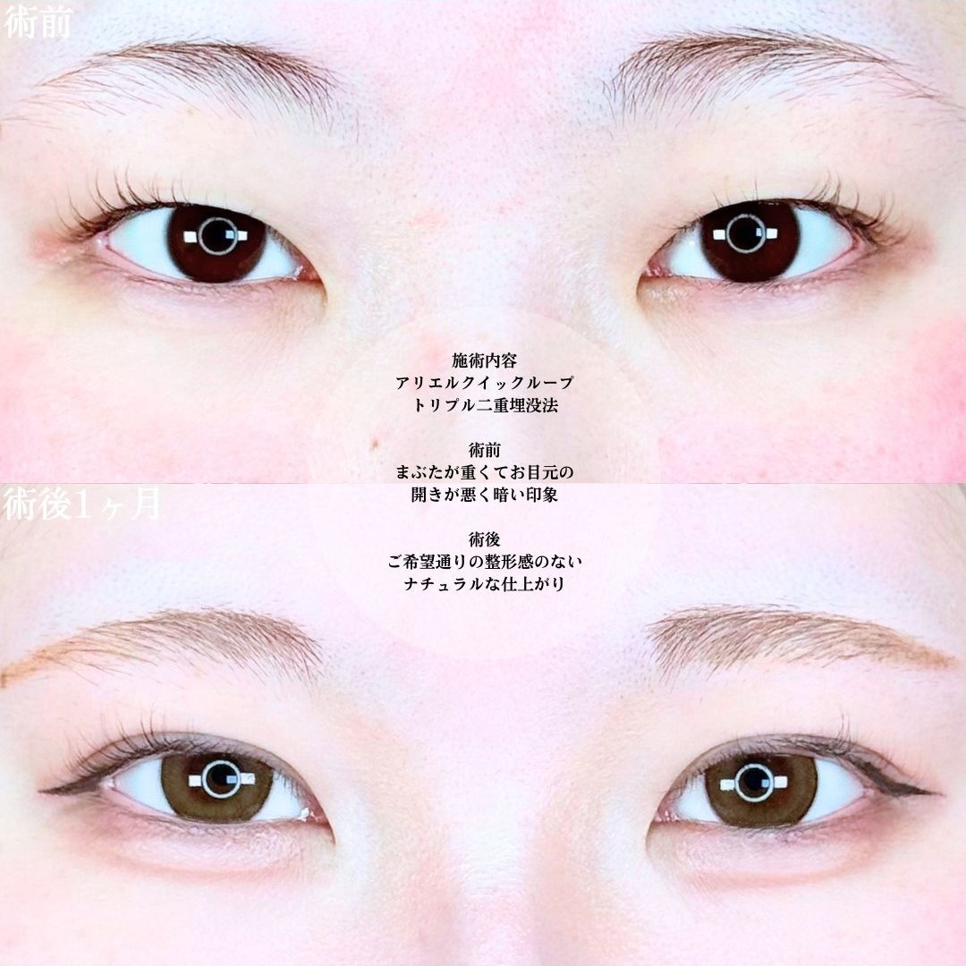 No.19369の症例写真1