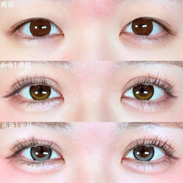 No.19051の症例写真