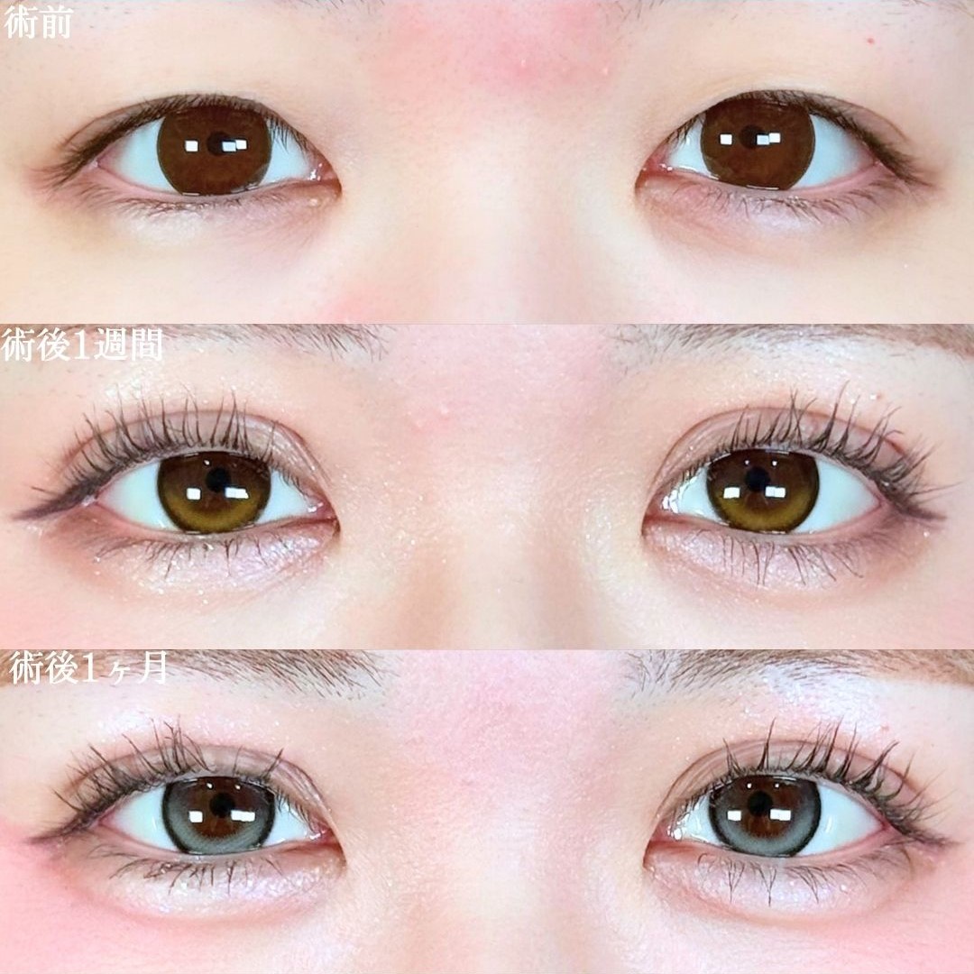 No.19051の症例写真